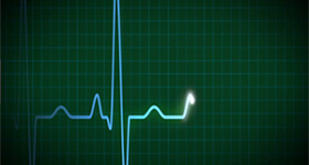Heart rate monitor